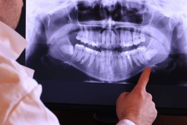 Best Urgent Dental Care in Wilson, NC