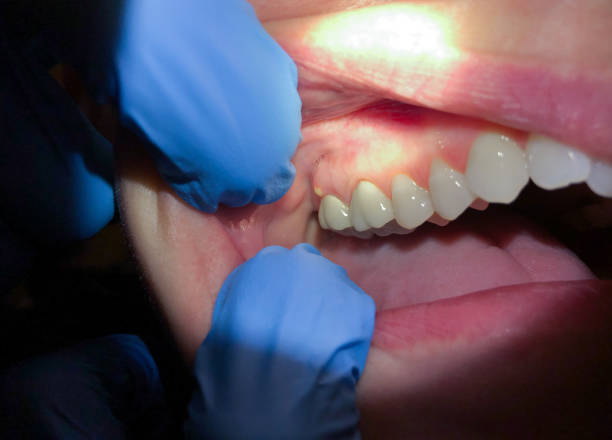 Best Emergency Dental Surgery in Wilson, NC